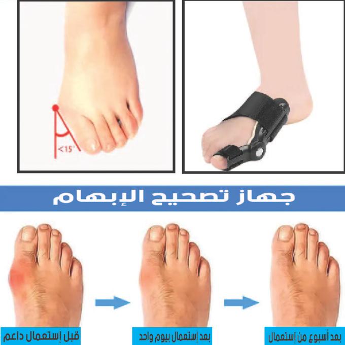جهاز تصحيح القدم
